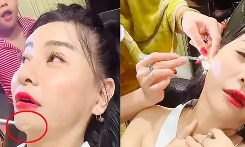 Nghệ sĩ Cát Phượng phát hiện dị vật trong tai, là thứ gì mà khiến cô khóc thét?