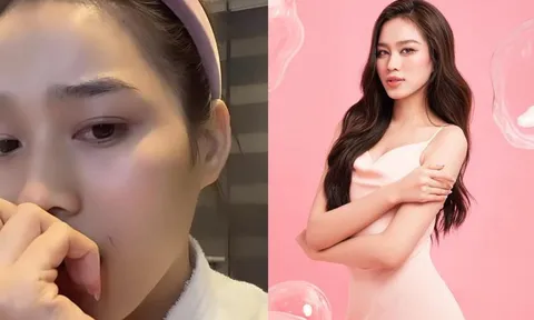Hoa hậu Đỗ Thị Hà vô tình tự tạo vết thương trên má, để lộ biểu cảm hoang mang