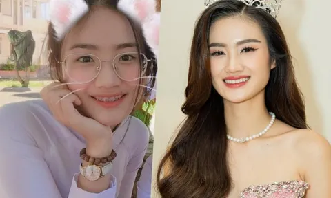 Hoa hậu Ý Nhi thăng hạng nhan sắc nhờ niềng răng