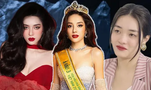 Á hậu 'đập mặt xây lại' công khai tiền sửa mũi, nghe xong ai cũng choáng!