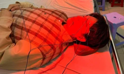 Ca sĩ Nguyễn Trần Trung Quân bị liệt nửa mặt, phải nhập viện cấp cứu