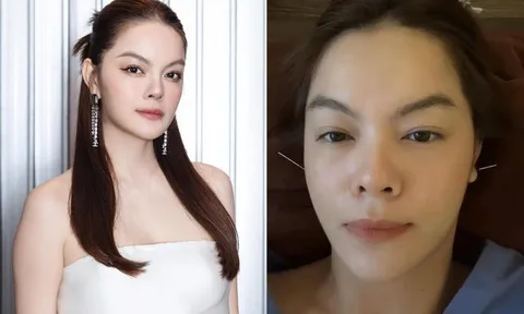 Phạm Quỳnh Anh gặp sự cố sức khoẻ, phải dùng kim châm để điều trị