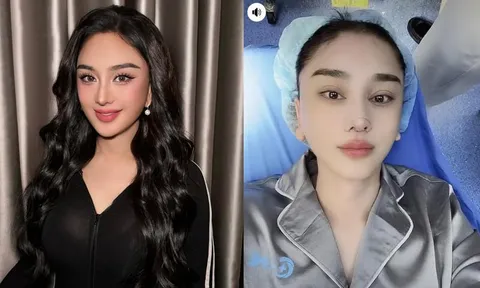 Hình ảnh mới nhất của Lâm Khánh Chi sau khi tiếp tục can thiệp 'dao kéo'