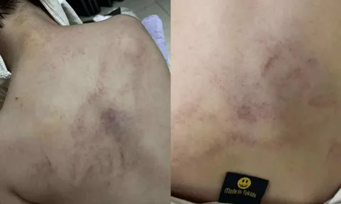Giáo viên mầm non bạo hành bé gái 4 tuổi, Ban Giám hiệu 'sốc' khi xem lại camera