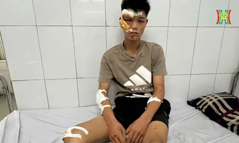 Lời khai gây phẫn nộ của quái xế thông chốt tông một Đại uý chấn thương nặng