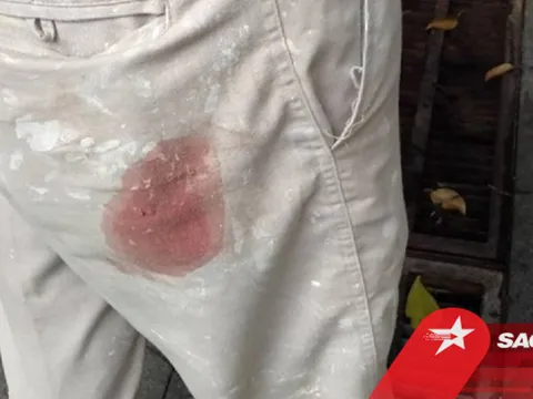 Một người đàn ông bị đạn bắn vào mông trong lúc sơn tháp chuông nhà thờ ở Sài Gòn