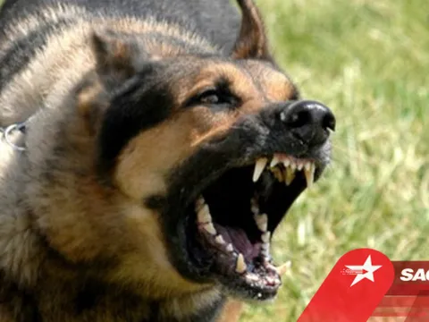 Sau vụ chó Pitbull tấn công chết người, lại thêm vụ bé trai 3 tuổi bị chó cắn nát mặt gây sợ hãi