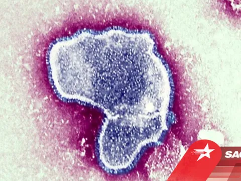 Thêm loại virus xuất hiện cùng lúc ở bệnh nhân nhí mắc Covid-19, khiến tỷ lệ nhập viện tăng