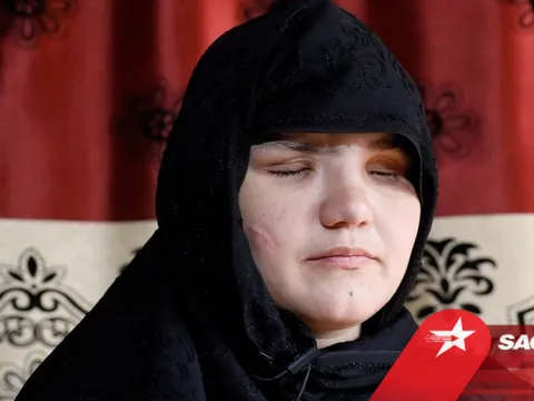 Ám ảnh lời kể của người phụ nữ bị Taliban khoét mắt, bắn 8 phát súng vào người