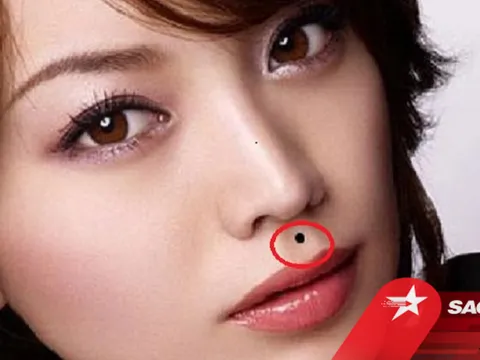 4 nốt ruồi 'tham lam' trên cơ thể, ai sở hữu nghèo khó cả đời, vừa dễ mất tiền lại vừa hại thân