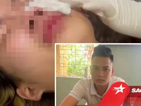 Lộ diện thanh niên xịt bình hơi cay vào mặt nữ sinh lớp 10 ở Hải Phòng sau cuộc trêu ghẹo