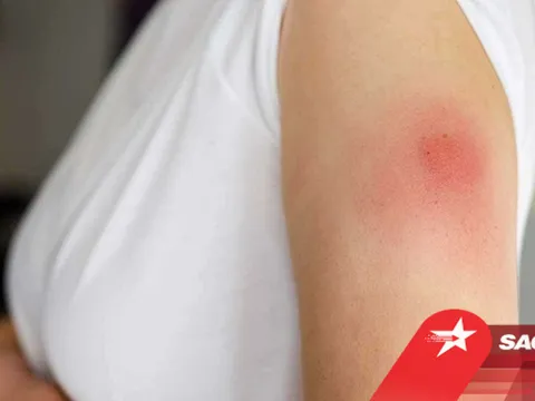 Những người 'dị ứng nghiêm trọng' phản ứng như thế nào sau khi tiêm vaccine Covid-19?