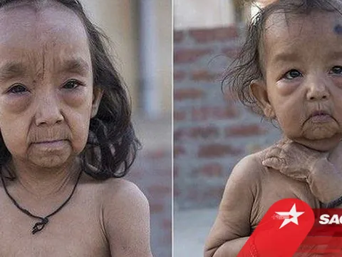 Hai chị em 7 và 18 tháng tuổi mang gương mặt già hơn cả cha mẹ, cuộc sống mỗi ngày gây xót xa