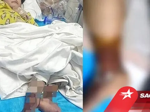 Bé gái 4 tuổi bị dì ghẻ bạo hành, dùng kim châm vào cơ thể, rót nước sôi vào người gây chấn động TQ
