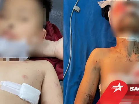 Sau tiếng nổ lớn nghi do pháo tự chế phát nổ, 4 học sinh bị thương nặng