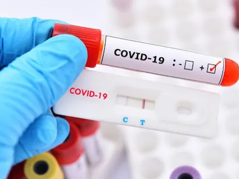Chuyên gia lý giải việc tiếp xúc với F0, có biểu hiện ho, sốt nhưng test vẫn âm tính