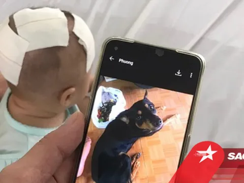 Xót xa bé gái 6 tháng tuổi bị chó cưng cắn xuyên xương sọ