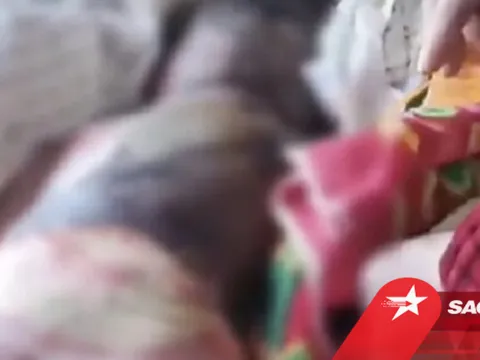 Bé trai bỏng toàn thân vì bị mẹ thả vào lửa, hành vi 'táng tận lương tâm' của ông bố còn ghê sợ hơn