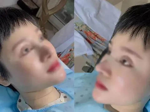 Sốt xình xịch với hình ảnh cô gái quyết tâm phẫu thuật giống Hiền Hồ để có chiếc G63