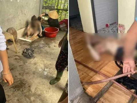 Mâu thuẫn gia đình, chồng đổ xăng đốt phòng ngủ khiến 3 người bỏng nặng