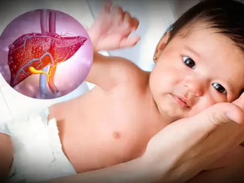 Bộ Y tế: Theo dõi chặt chẽ bệnh viêm gan cấp tính 'bí ẩn' ở trẻ