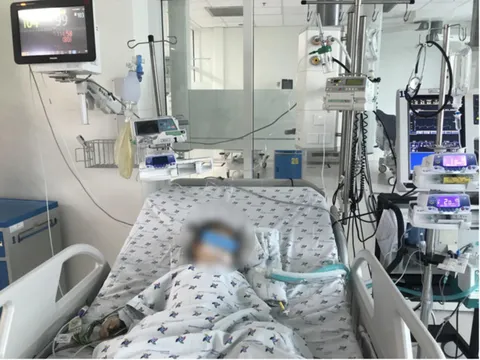 Bị dây ba lô quấn cổ, bé 2 tuổi suy hô hấp thiếu oxy não nhập viện khẩn cấp