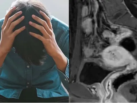 Người đàn ông bị sốc khi biết mình có buồng trứng, tử cung và kinh nguyệt hàng tháng