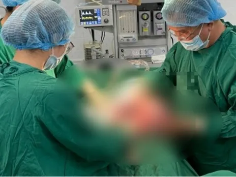 Bệnh nhân 26 tuổi được cắt khối u buồng trứng nặng 10kg