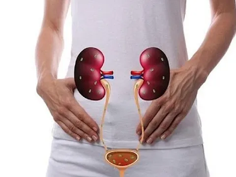 Nhiễm trùng đường tiểu có nguy hiểm không?