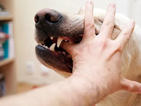 Cháu bé 7 tuổi tử vong sau gần 3 tháng bị chó cắn