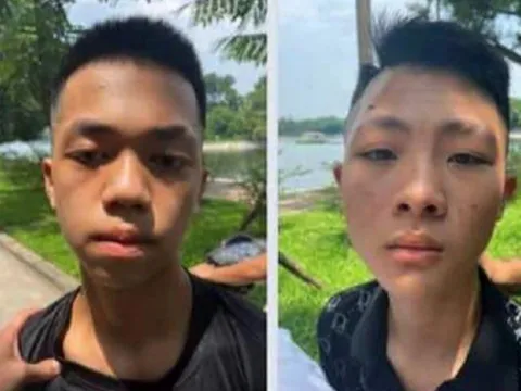 Thiếu niên 15 tuổi cầm đầu nhóm cướp tại Hà Đông bị bắt giữ