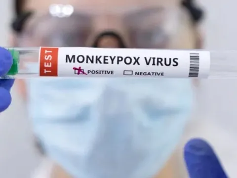Ca nghi lây nhiễm virus gây bệnh đậu mùa khỉ từ người sang chó đầu tiên được phát hiện