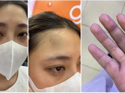 Cha ruột cô gái Hải Như mất tích tiết lộ thêm các chi tiết tại thời điểm phát hiện vật dụng của con gái