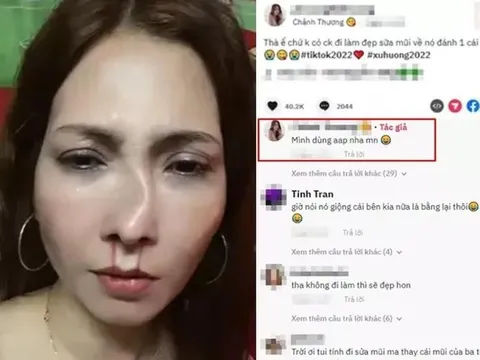 Người phụ nữ đăng đàn tố bị chồng đánh 'tòe mũi' mới nâng và sự thật khiến dân mạng bực mình