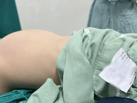 Bé gái 12 tuổi nhập viện khẩn vì bụng to bất thường