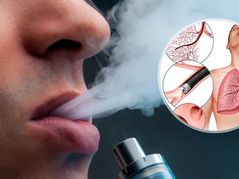 Đừng 'đùa' với thuốc lá điện tử