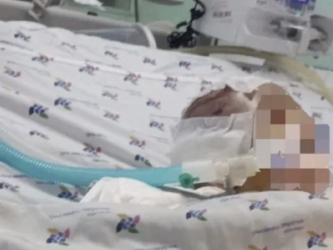 Bé trai 6 tháng tuổi bị bạo hành: Nạn nhân hôn mê sâu, tỷ lệ thương tích 99%
