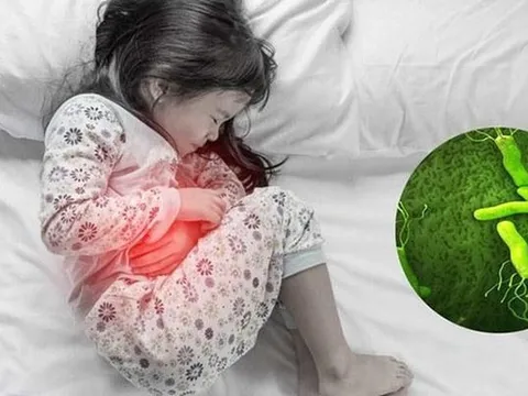 Những điều cần biết về vi khuẩn HP ở trẻ em