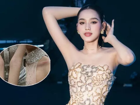 Đỗ Thị Hà đăng tải ảnh thân thể trầy xước trong đêm khiến fan xót xa
