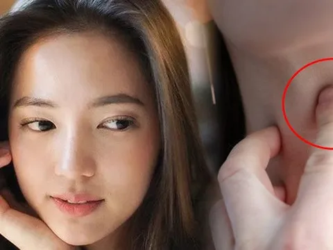 Thời điểm phụ nữ có nguy cơ mắc K tuyến giáp cao nhất trong đời, BS khuyên nên thận trọng tầm soát