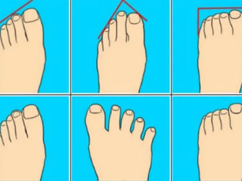 Nhìn tướng bàn chân, đoán ngay tương lai giàu có hay nghèo nàn