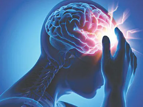 Dự báo số ca tử vong do đột quỵ trên thế giới có thể tăng 50% vào năm 2050