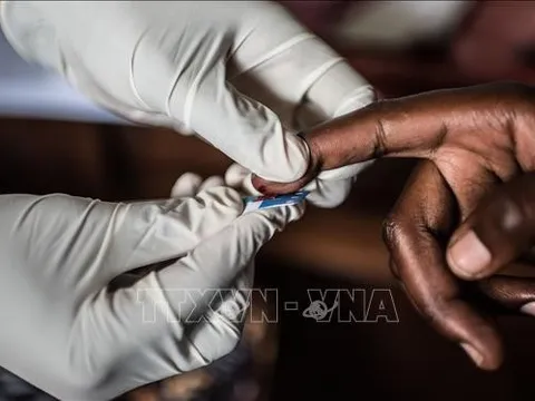 WHO kêu gọi châu Âu chống kỳ thị liên quan đến việc xét nghiệm HIV