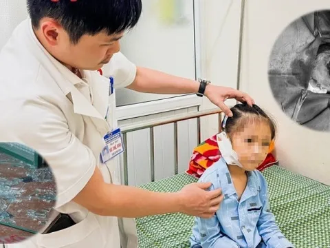 Nghệ An: Bé gái đứt tai vì kính vỡ trong lúc chơi đùa ở nhà
