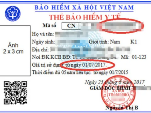 Vì sao thẻ BHYT mẫu mới không ghi ngày hết hạn sử dụng?