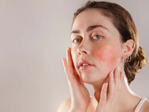 Dấu hiệu cảnh báo làn da thiếu vitamin C