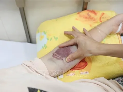 Số ca mắc sốt xuất huyết tăng nhanh tại phố núi Bảo Lộc