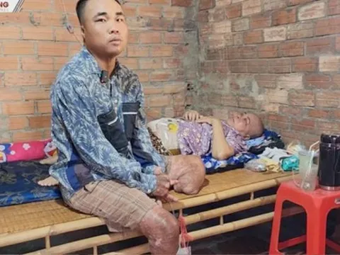 Lao vào biển lửa cứu mẹ, anh phụ hồ bị mất đôi chân nhưng vẫn mưu sinh kiếm sống