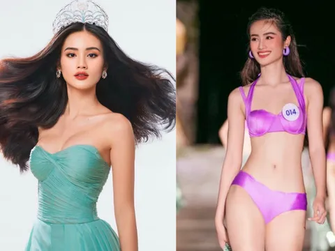 Hoa hậu Ý Nhi bị nghi 'dao kéo'