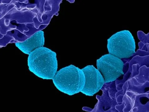 Nhật Bản: Các ca nhiễm liên cầu khuẩn tăng lên mức cao kỷ lục